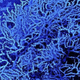 purkinje cell
